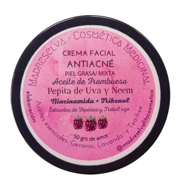 crema antiacne